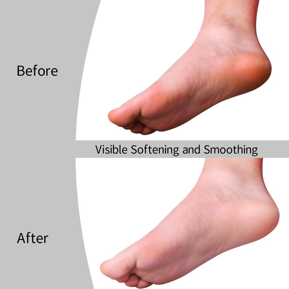 Eiszhjk three-pack rollers offer budget-friendly foot maintenance.