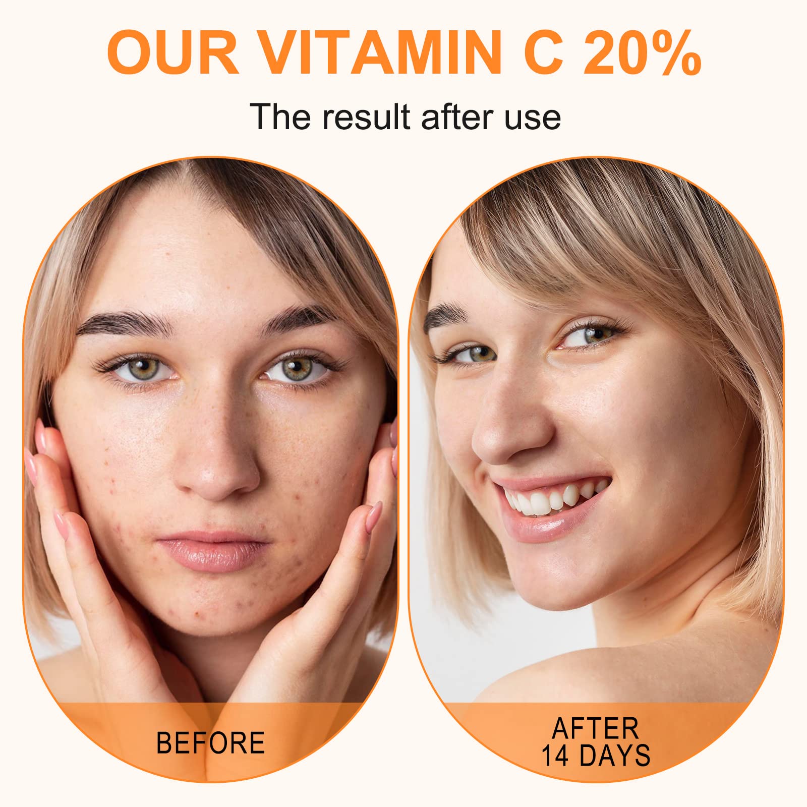 ELBBUB Sérum Vitamina C 20% aplicacion-manana, hidratación ligera durante el día.
