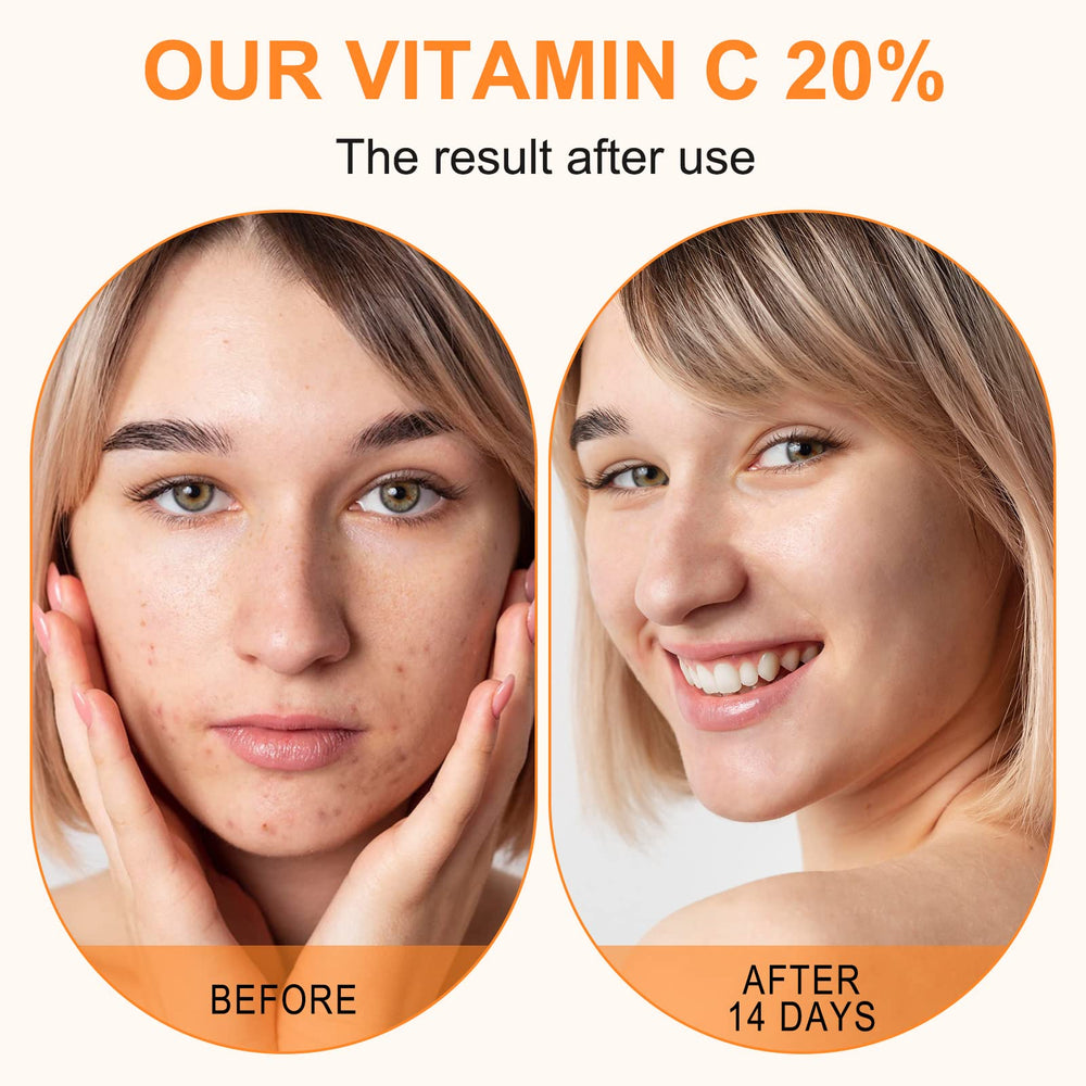 ELBBUB Sérum Vitamina C 20% aplicacion-manana, hidratación ligera durante el día.