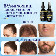 Elegra Minoxidil aumenta volumen del cabello con uso constante