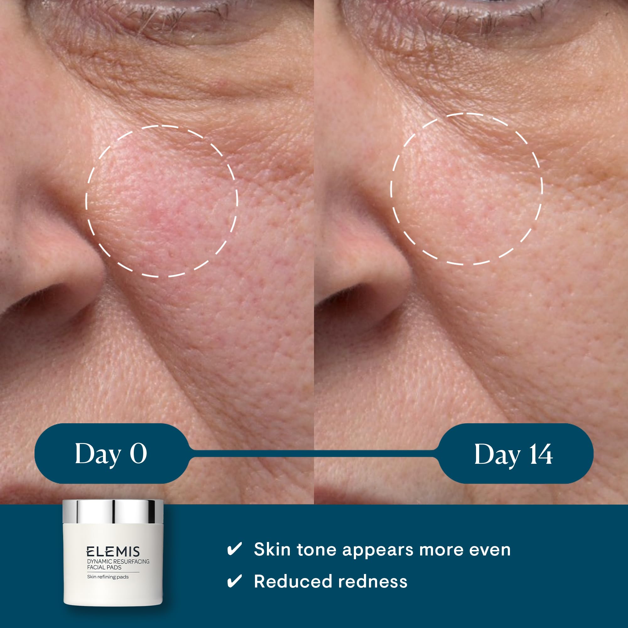 Close-up of textured side pad for gentle exfoliation.