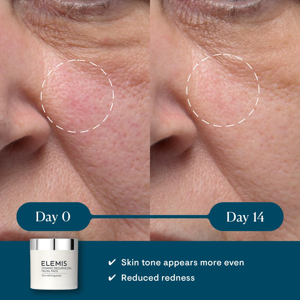 Close-up of textured side pad for gentle exfoliation.