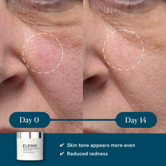 Close-up of textured side pad for gentle exfoliation.