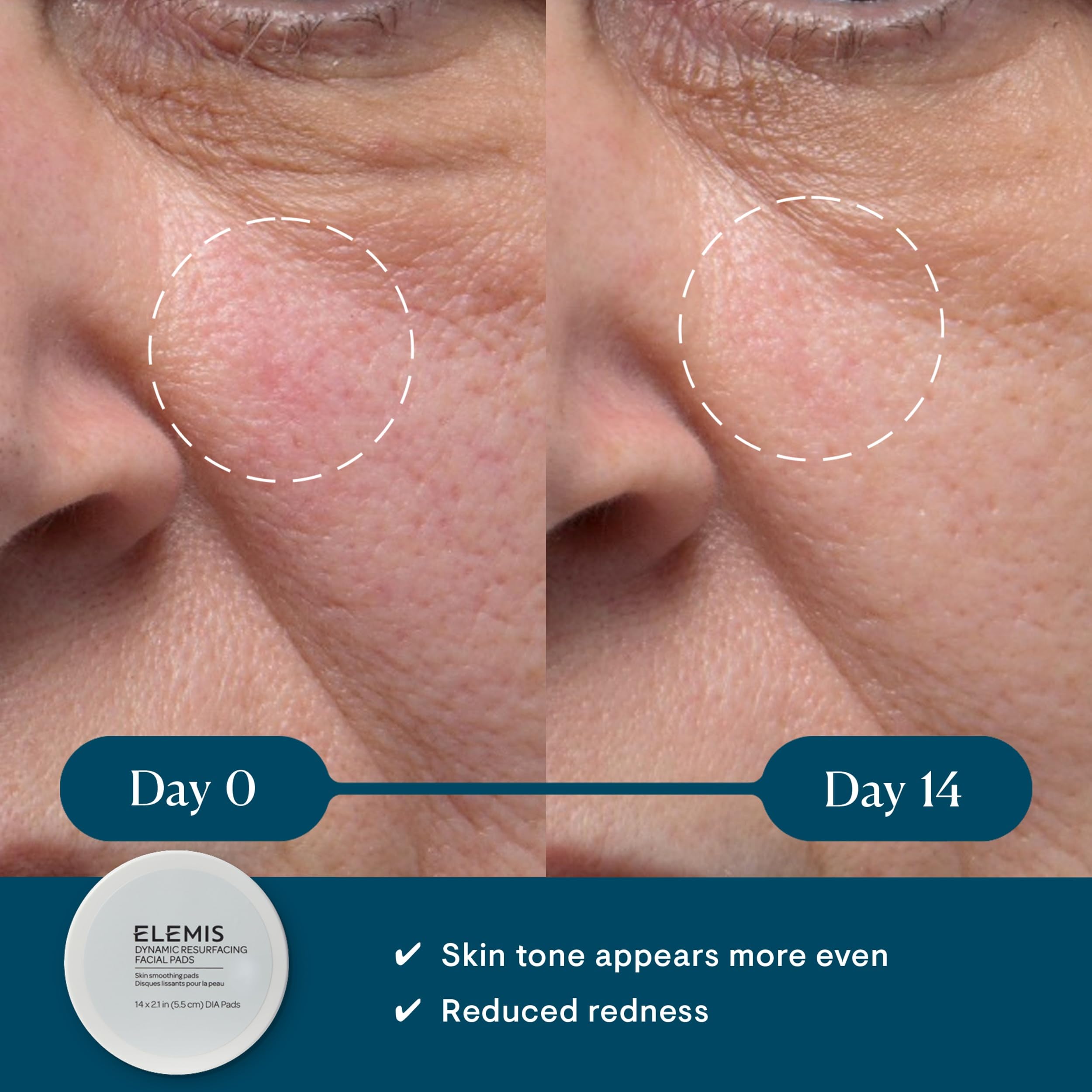 ELEMIS Dynamic Resurfacing Pads textured side closeup for exfoliation texture.