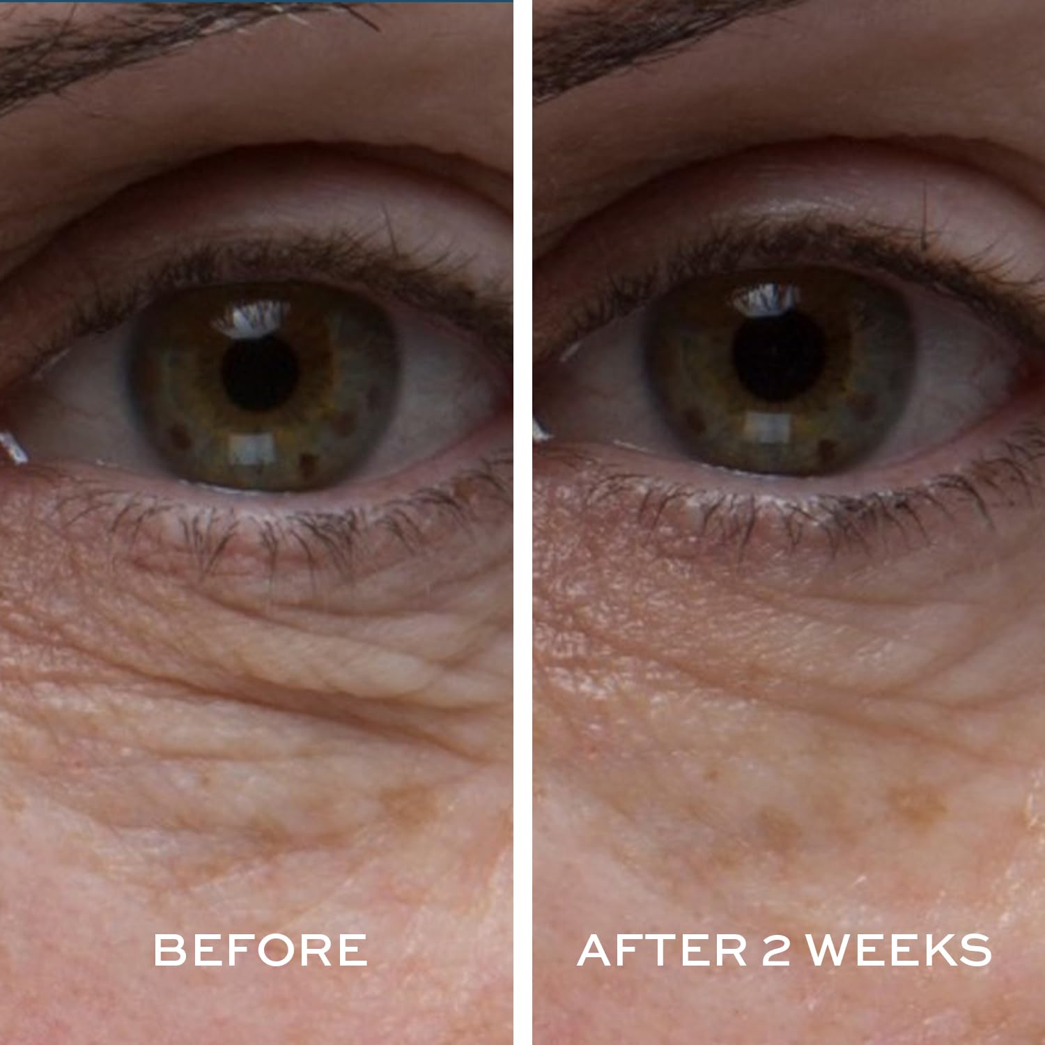Dab application with ELEMIS Peptide4 Eye Recovery Cream around eye.