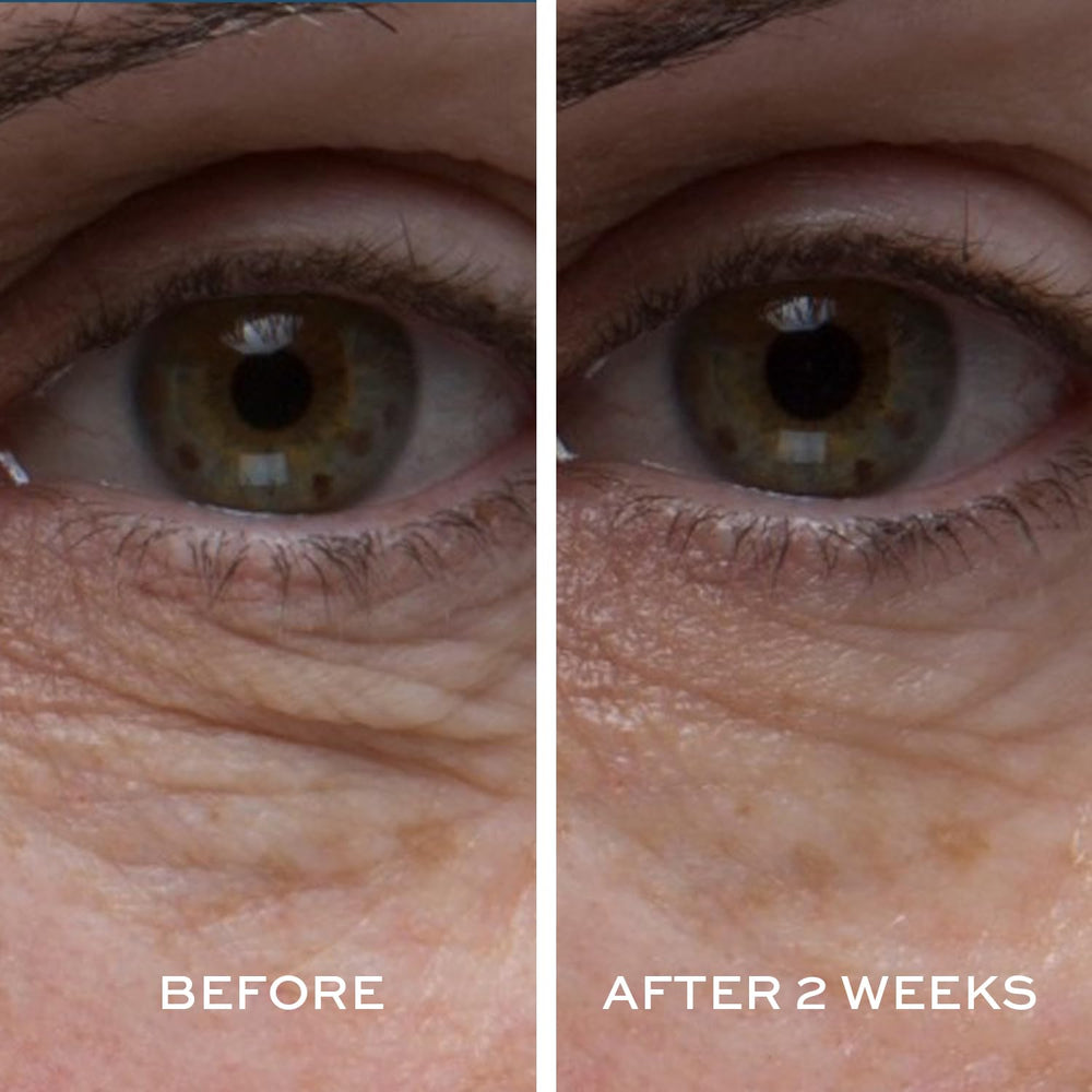 Dab application with ELEMIS Peptide4 Eye Recovery Cream around eye.