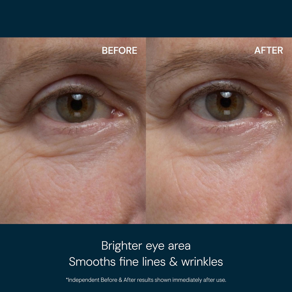 Elemis eye Revive Mask brightening under-eye area for a more awake look.