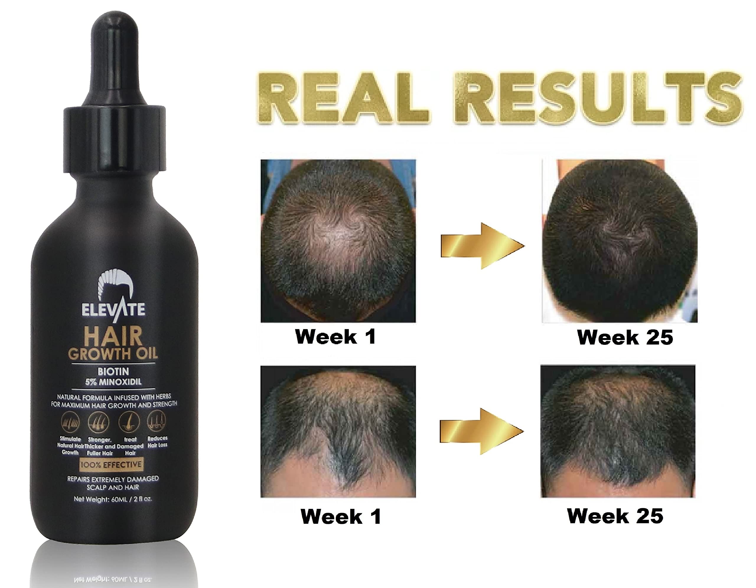 Elevate hair regrowth benefits visible in daily styling with thicker-looking strands.