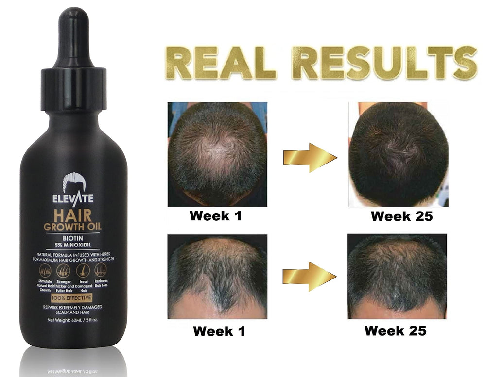 Elevate hair regrowth benefits visible in daily styling with thicker-looking strands.