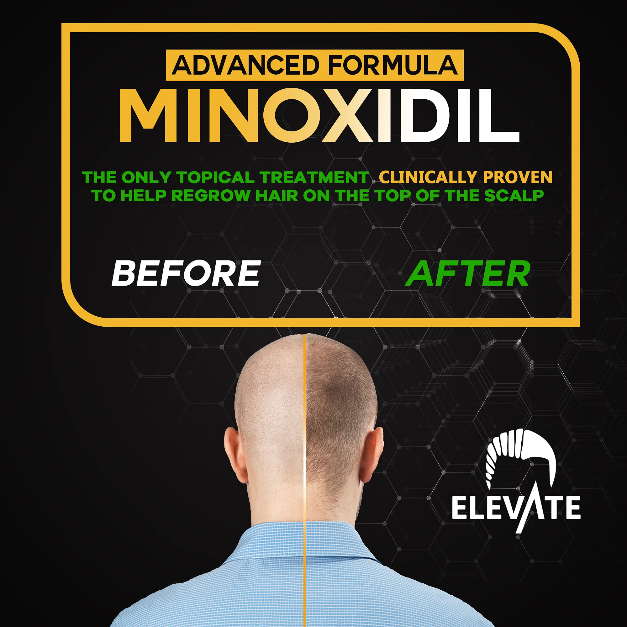Elevate Minoxidil, spray de textura ligera para peinar sin residuo