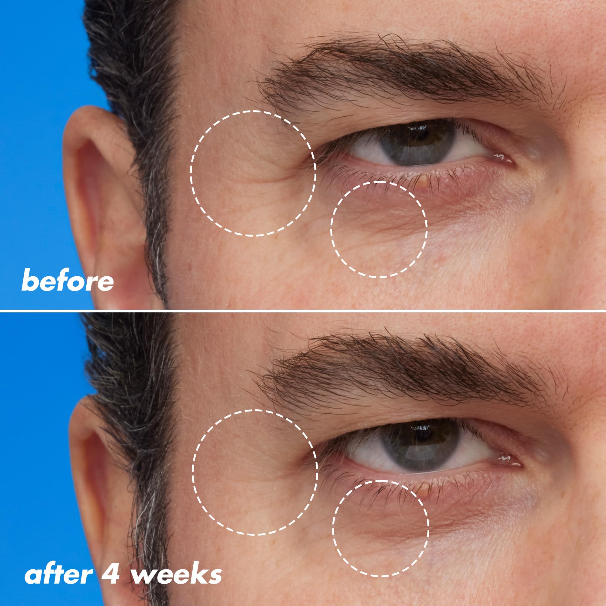 e.l.f. SKIN granactivo retinoide Blue-ty, ingrediente clave para renovación suave