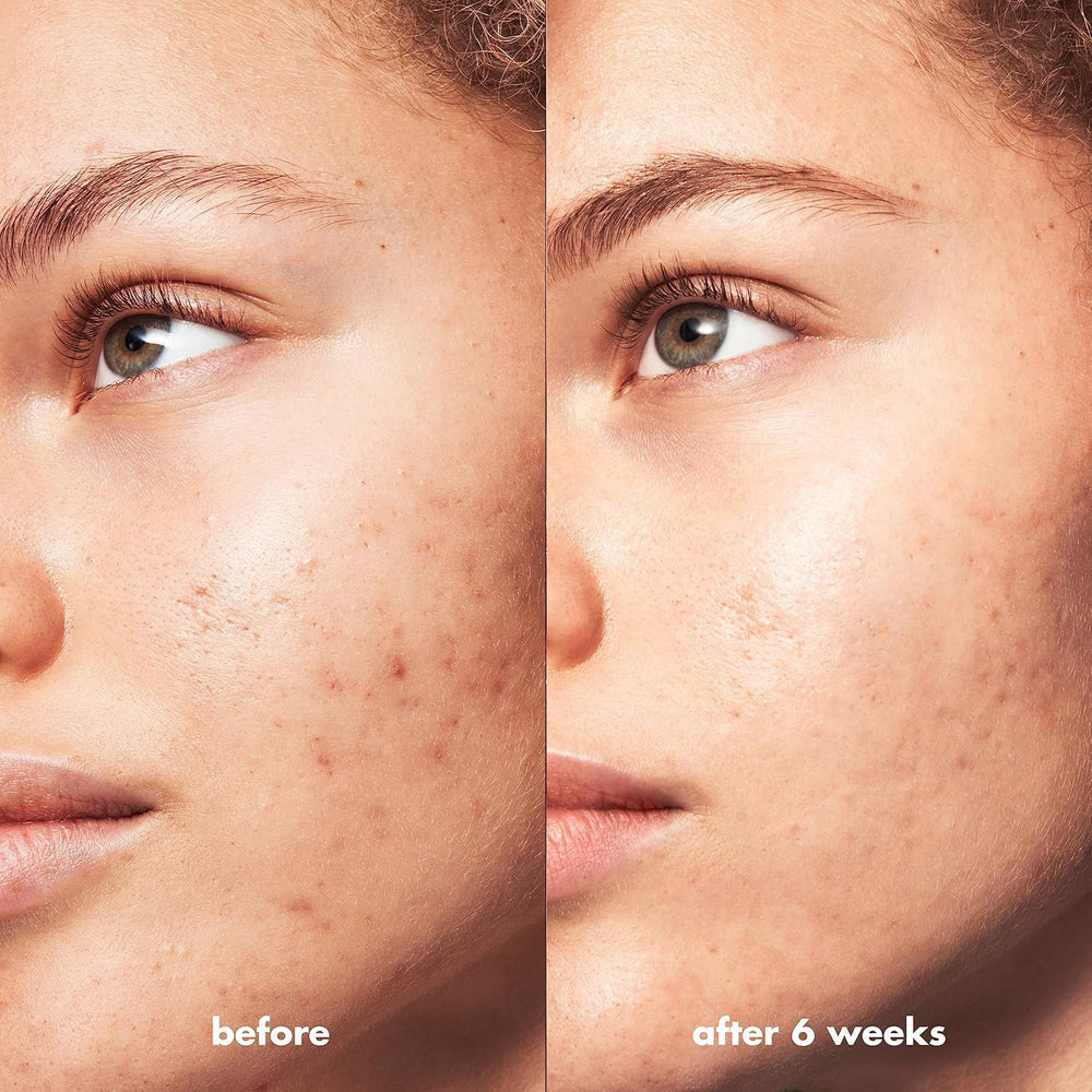 e.l.f. SKIN Suero Textura ligera: se absorbe sin sensación grasa