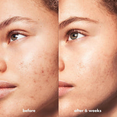 e.l.f. SKIN Suero Textura ligera: se absorbe sin sensación grasa