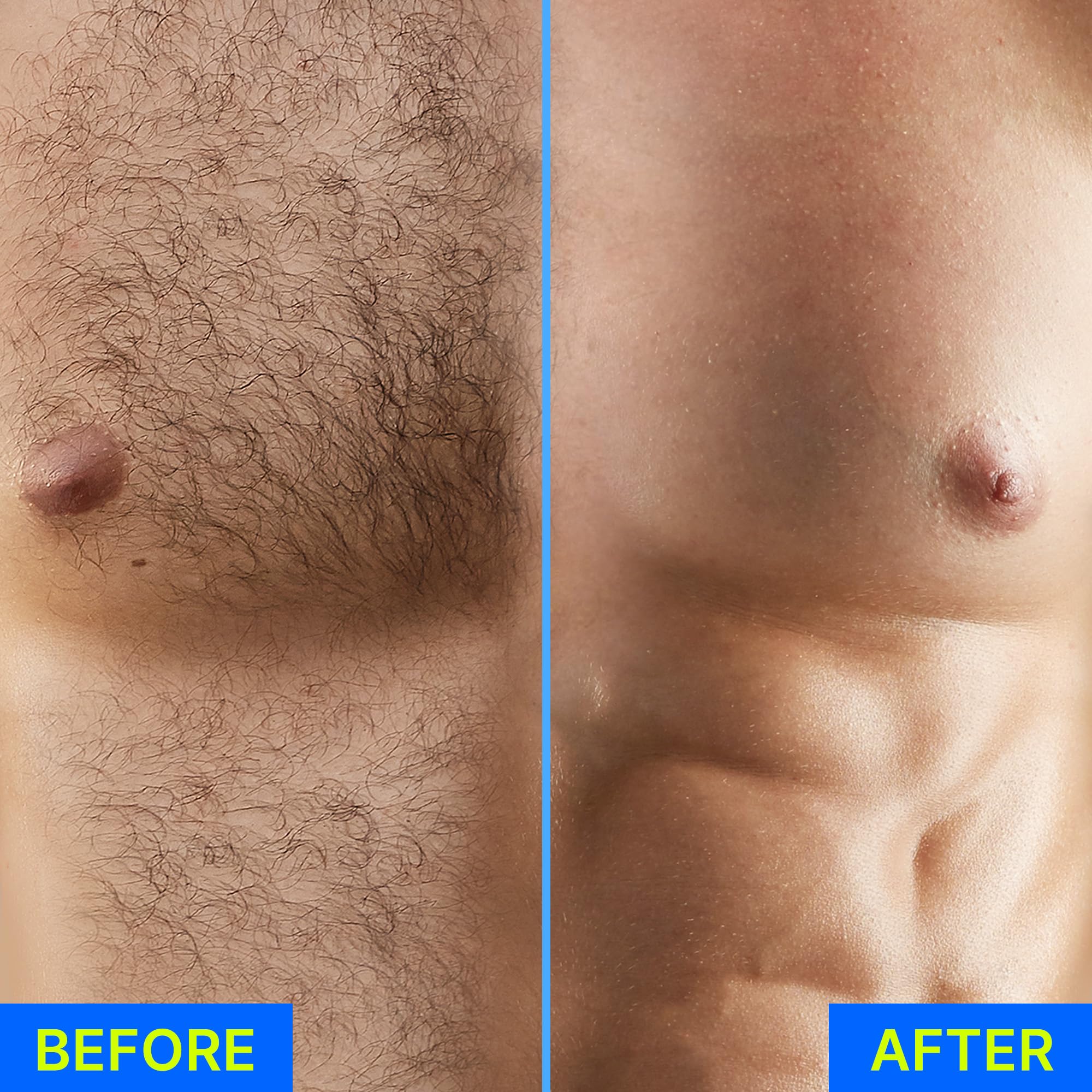 ELIAGLOW full bikini area depilation for sensitive zones