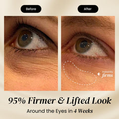 Eliré eye cream application close-up demonstrates precise, smooth blending.