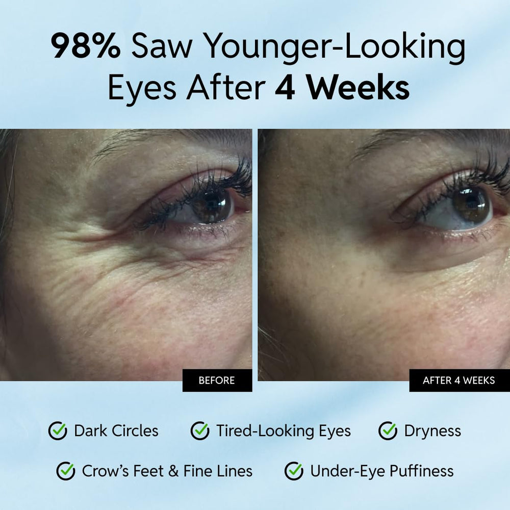 Eliré eye cream application under the eye for de-puffing support.