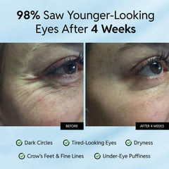 Eliré eye cream application under the eye for de-puffing support.
