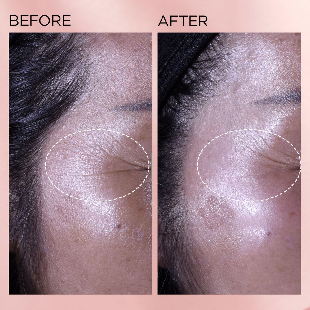 Graphic of ceramides peptides and Niacinamide ingredients