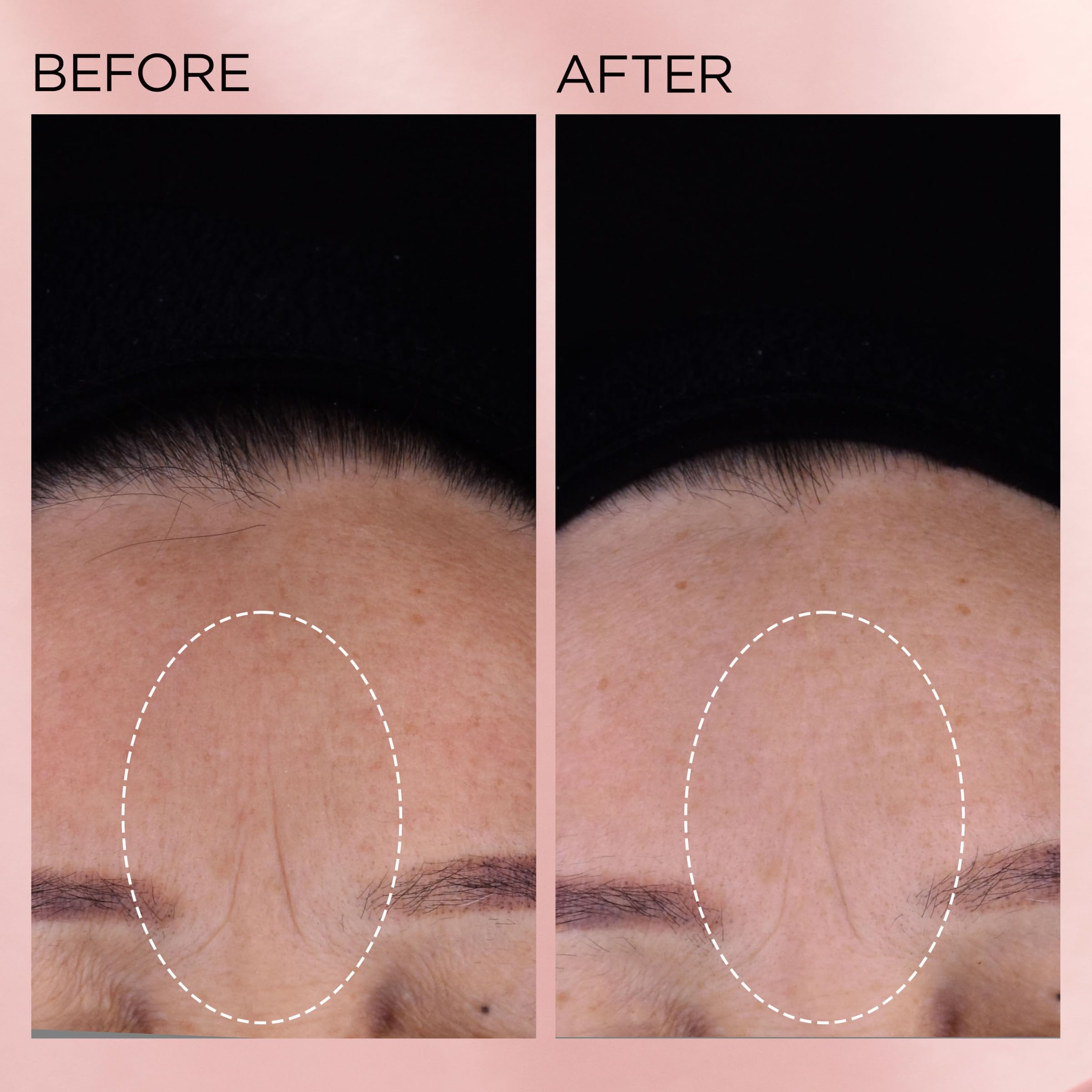 Elizabeth Arden phytoceramides depiction emphasizes barrier-strengthening components