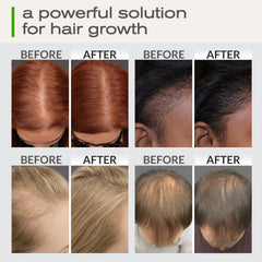 Ella & Eden Hair Growth Oil dropper used for precise application to roots and strands.