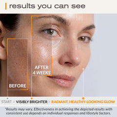 Ella & Eden Vitamin C Serum ingredients with green tea and CoQ10