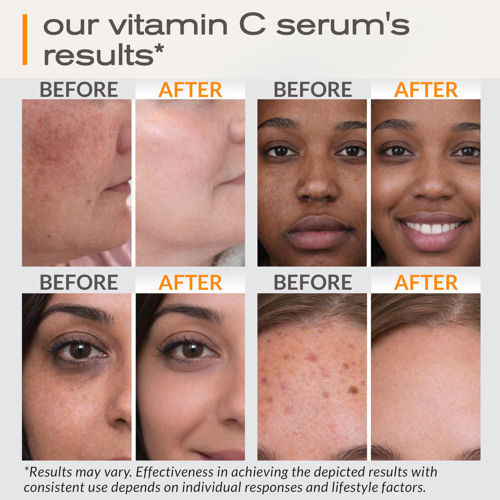 Ella & Eden Vitamin C Serum on skin showing lightweight texture