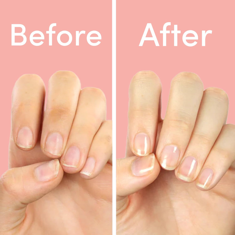 Ella Mila before and after nails showing damage repair progress.