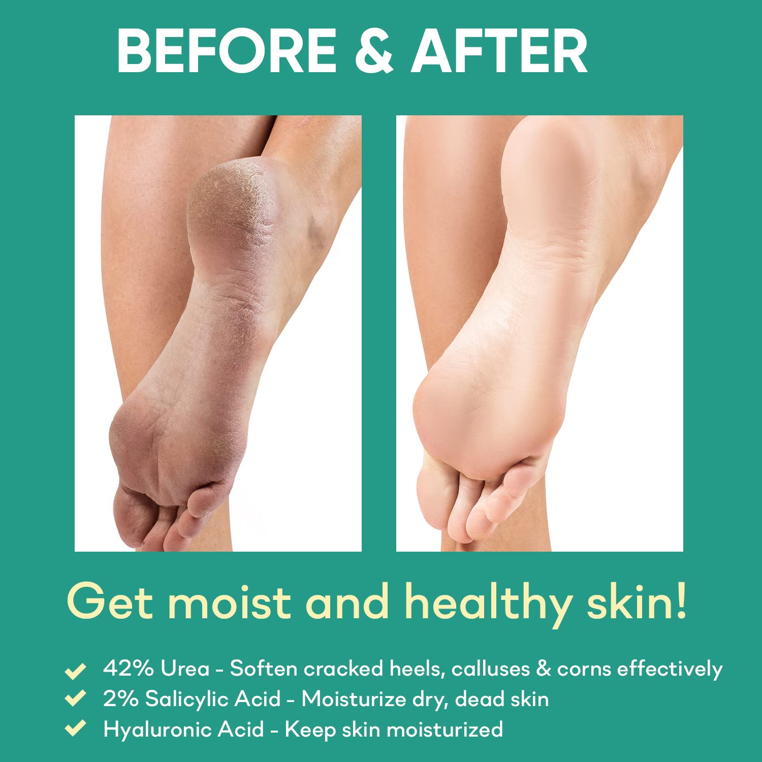 Textura suave de Ellocy gel con urea, fácil de usar.