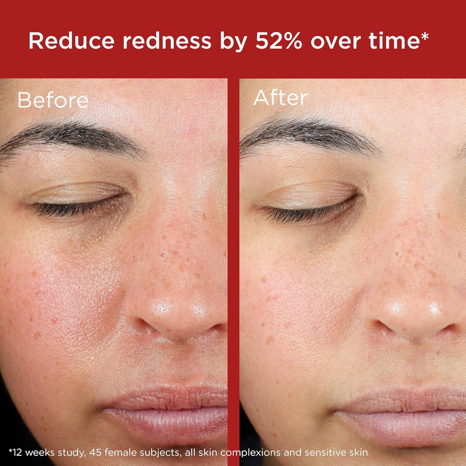 EltaMD green tint visually reduces redness when applied.