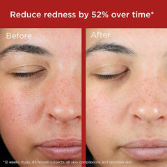 EltaMD green tint visually reduces redness when applied.
