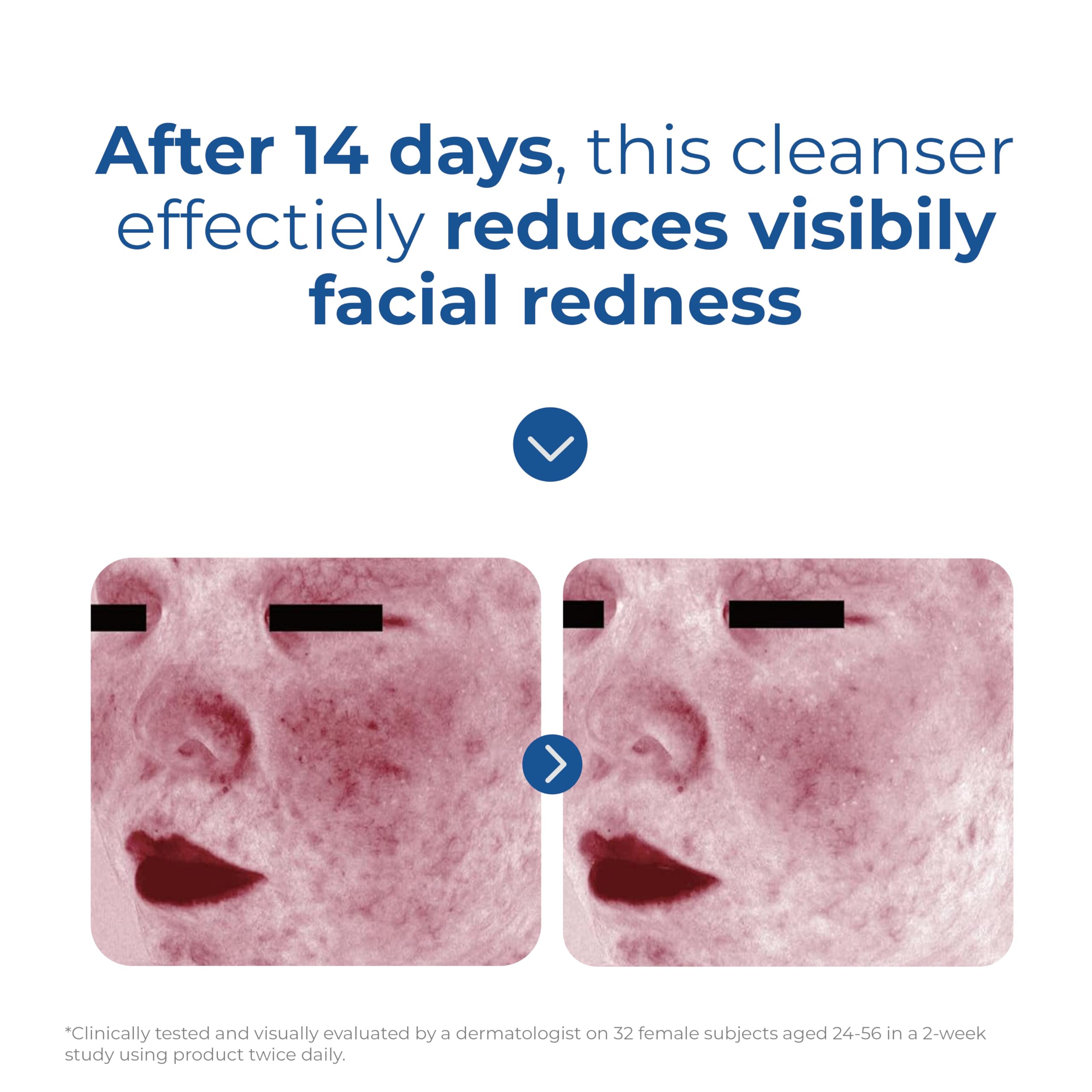 Daily morning and night routine with EltaMD Skin Recovery cleanser.