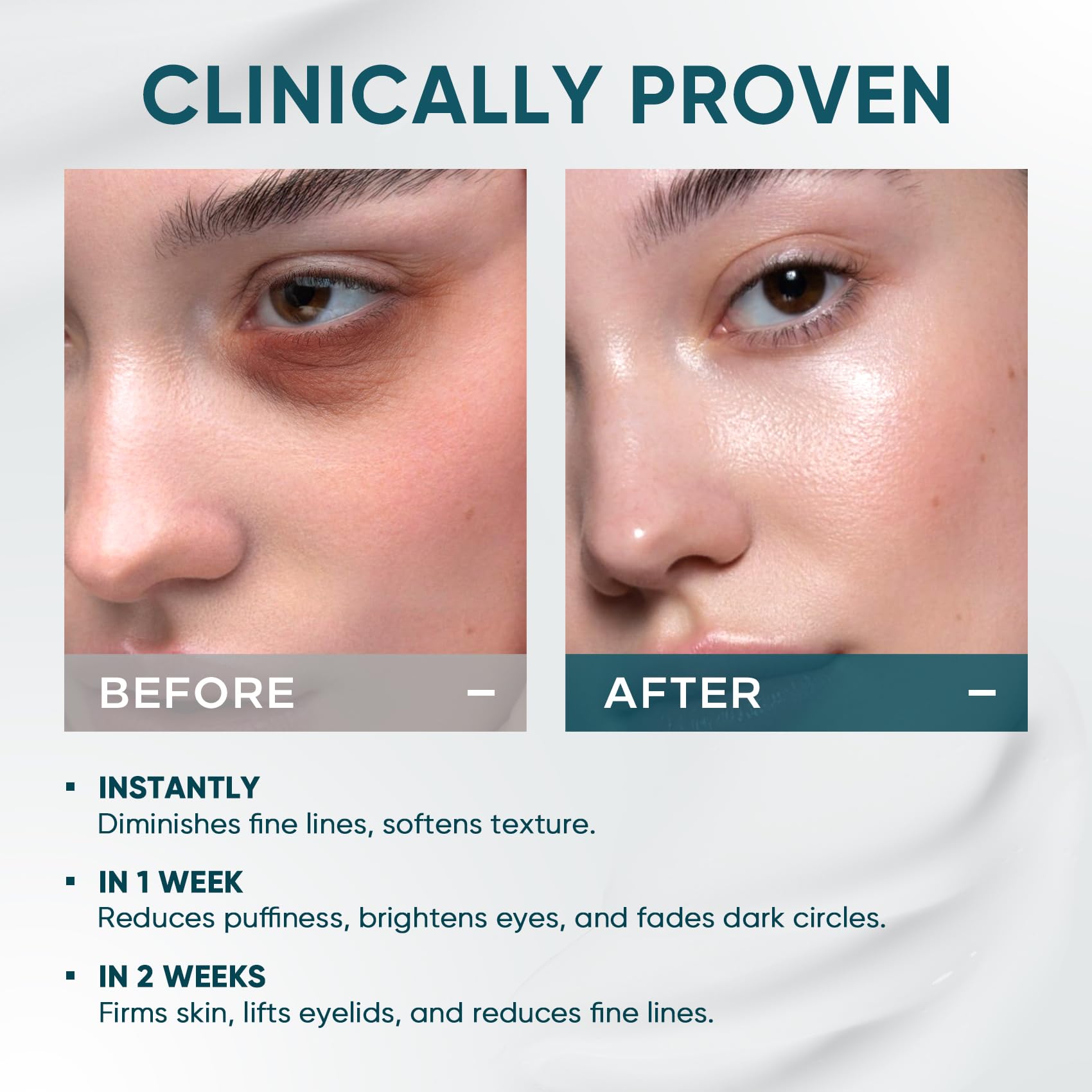 Elvira eye cream with retinol and peptides supports skin vitality.