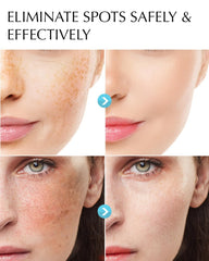 EnaSkin Dark Spot Remover 2-Pack body bottle showing multi-area use.