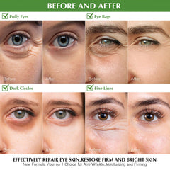 Empaque Enaskin Naturals de parches oculares, listo para cuidado diario.