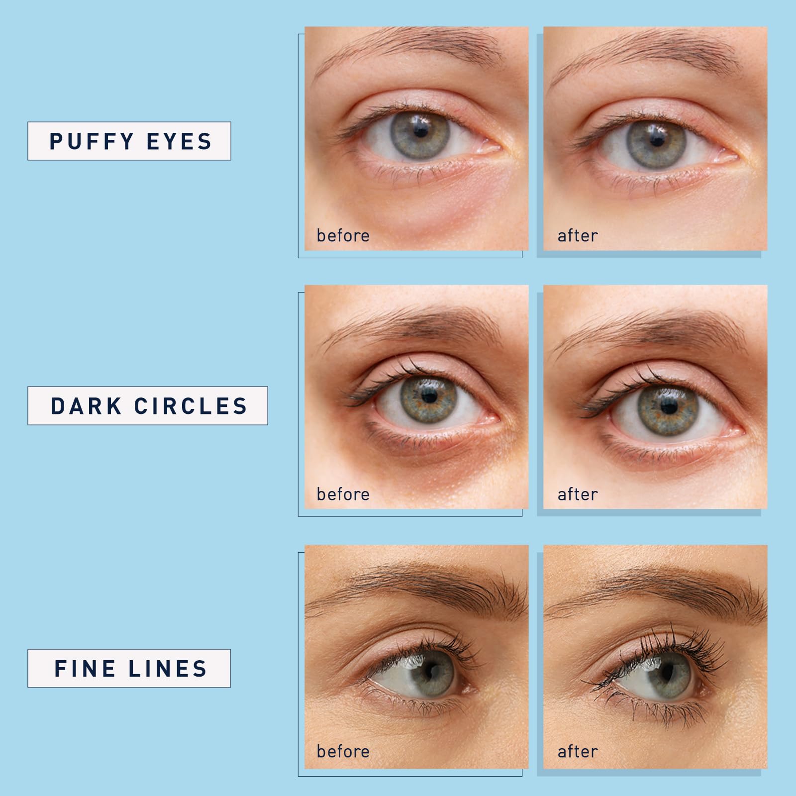 Parches Enaskin Naturals ojos adherencia hidrogel para una aplicación cómoda.