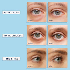 Parches Enaskin Naturals ojos adherencia hidrogel para una aplicación cómoda.
