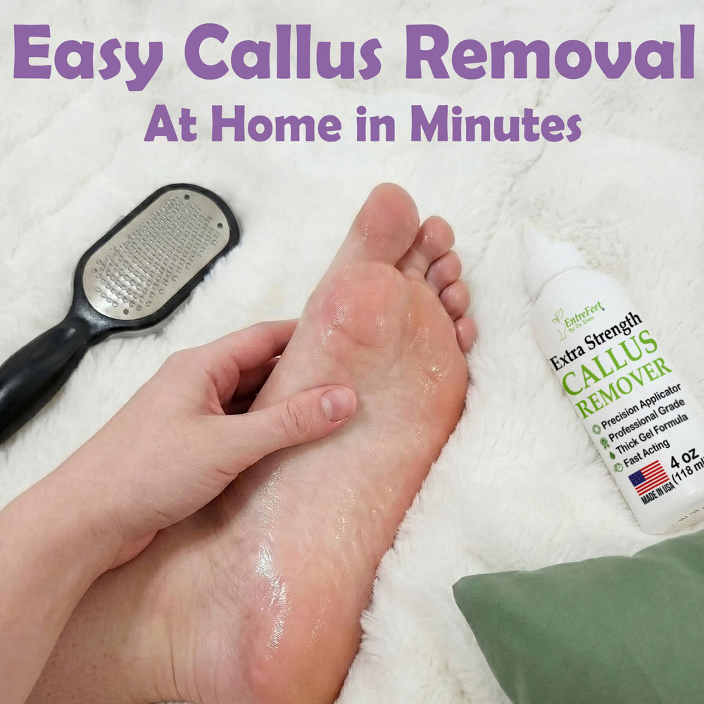 EntreFeet professional-grade callus remover gel delivers salon care at home.