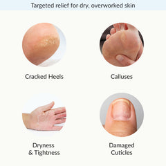 Epielle shea butter rich formula emphasizes intense hydration and repair.