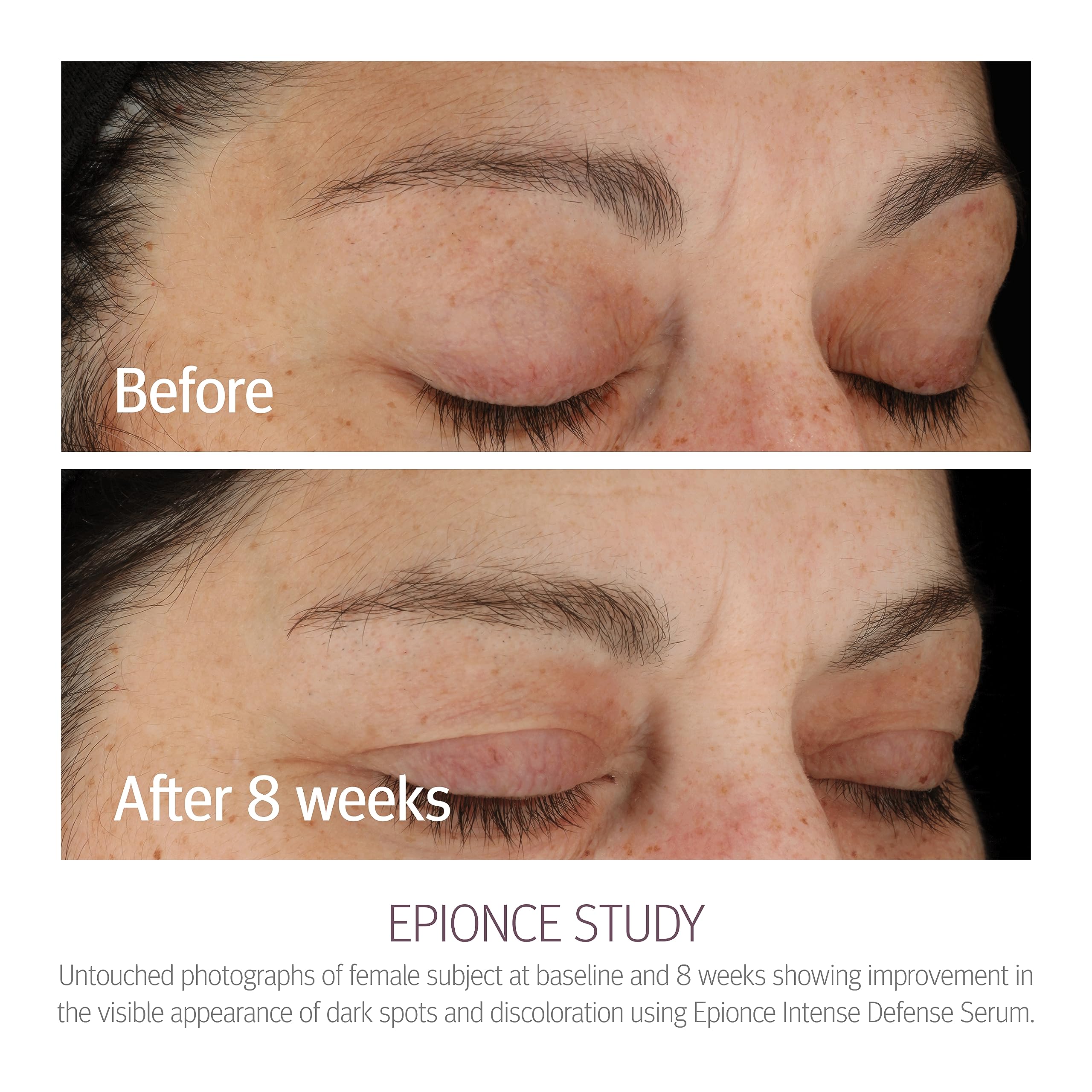 Epionce Intense Defense Serum texture swirled on skin for absorption.