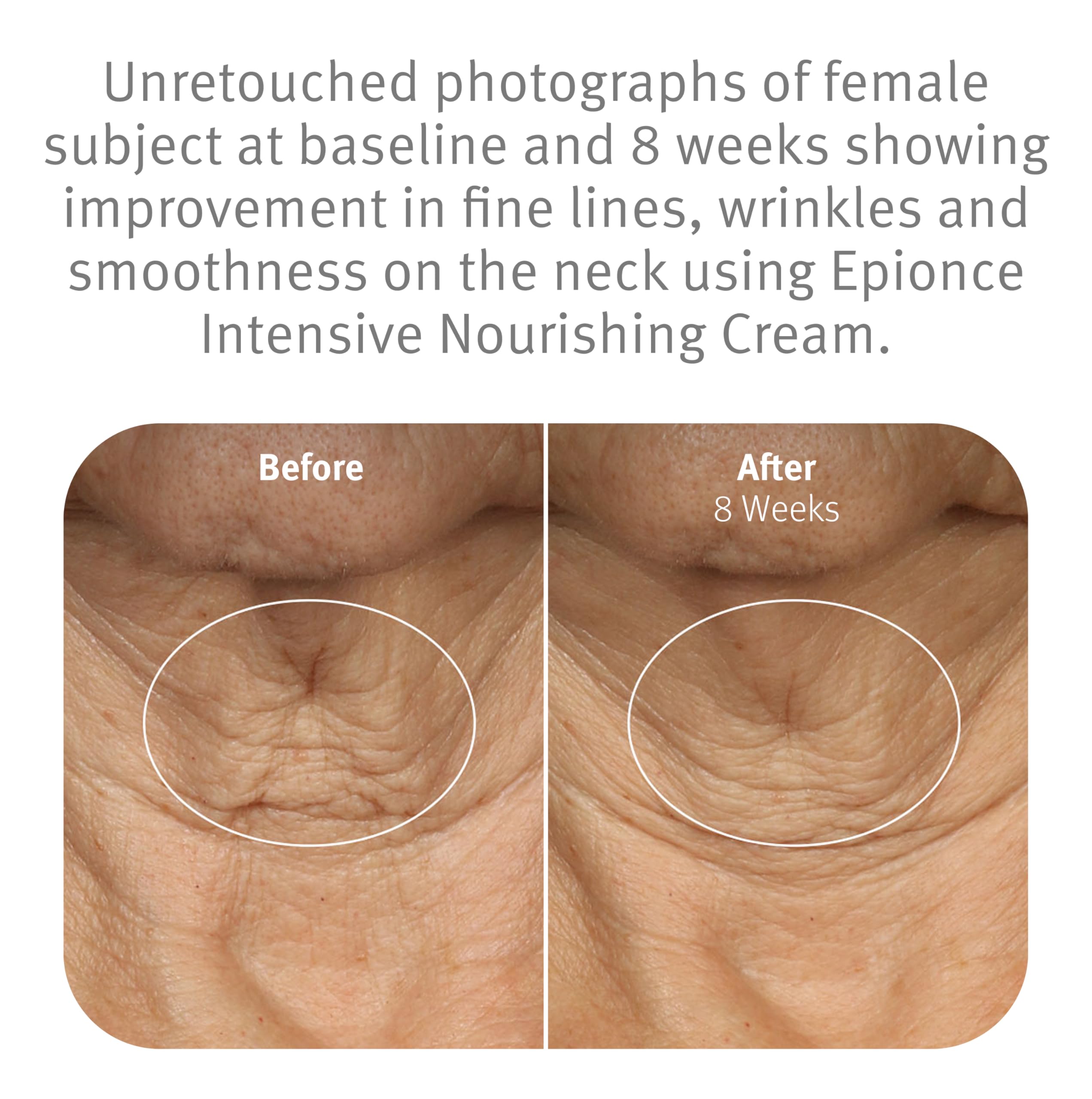Epionce Intensive Nourishing Cream rich texture delivers a velvety finish for dry skin.