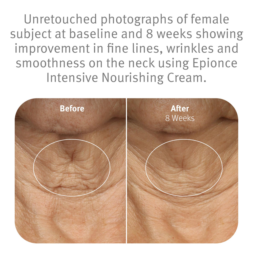 Epionce Intensive Nourishing Cream rich texture delivers a velvety finish for dry skin.