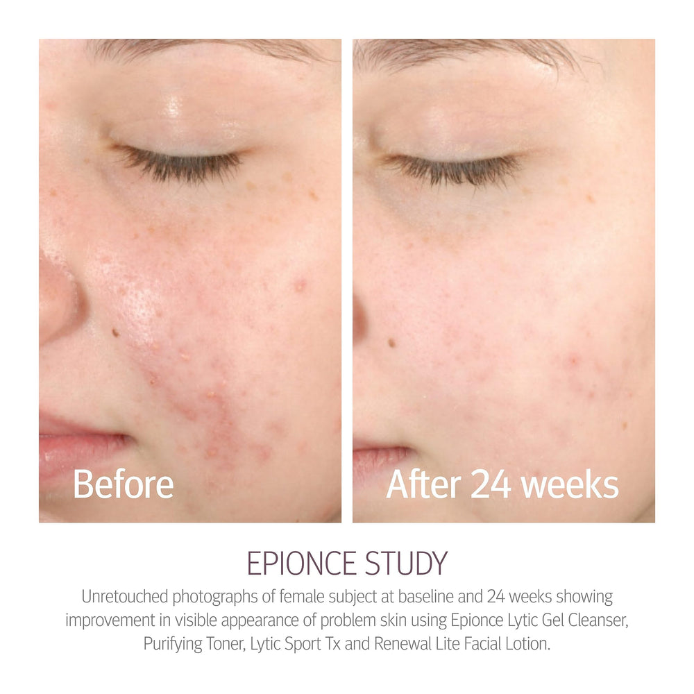 Applying with a cotton pad for gentle skin prep with Epionce toner.