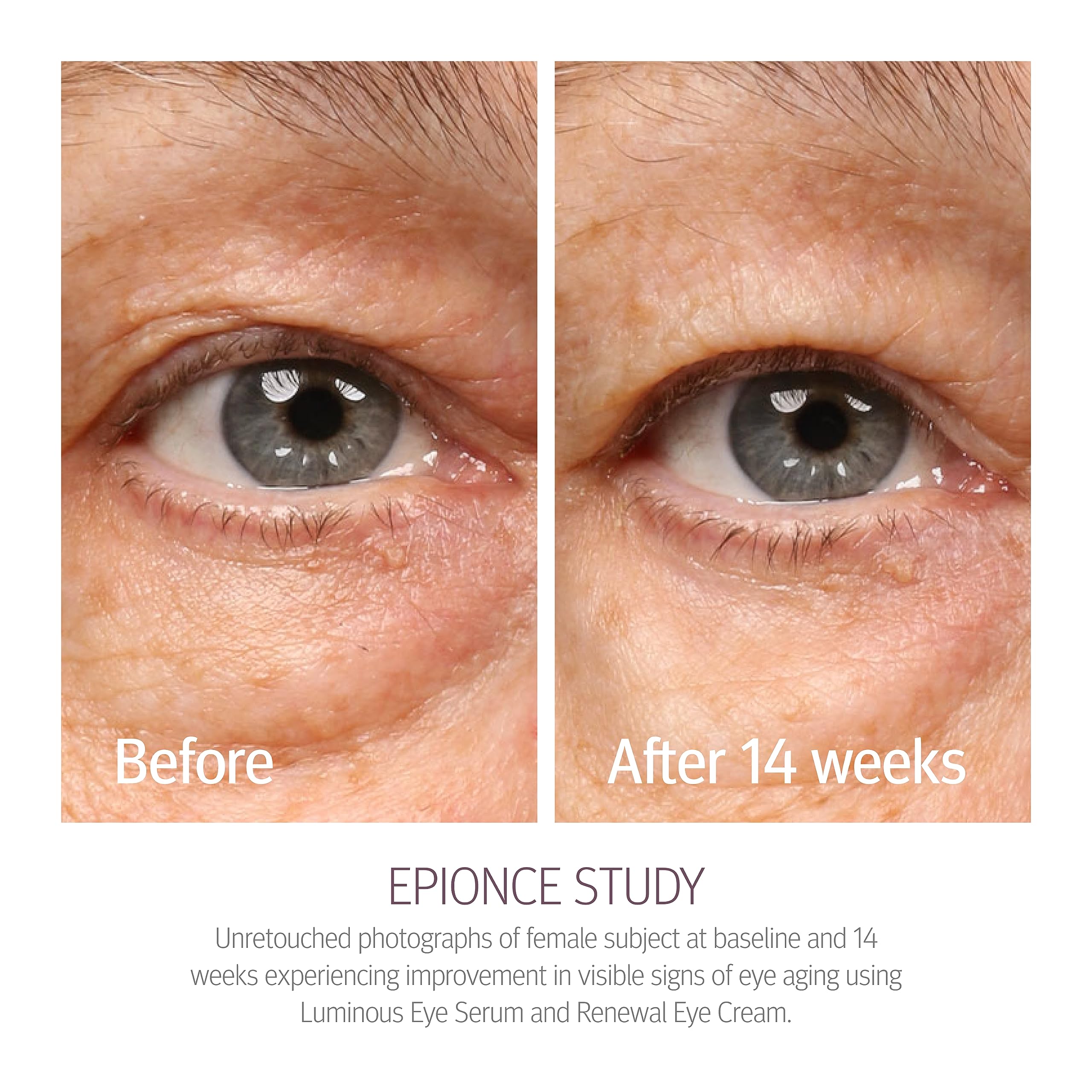 Epionce Renewal Eye Cream being dispensed from a pump during use.