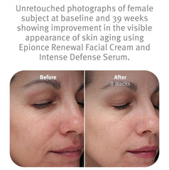 Apply Epionce Renewal Facial Cream on face for smooth, even coverage