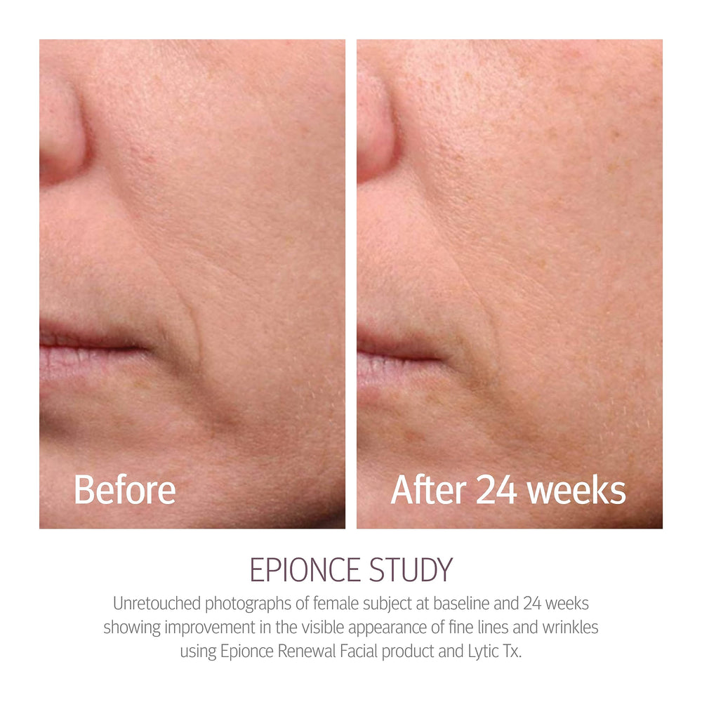 Epionce Renewal Facial Lotion texture close up highlighting a silky lightweight formula