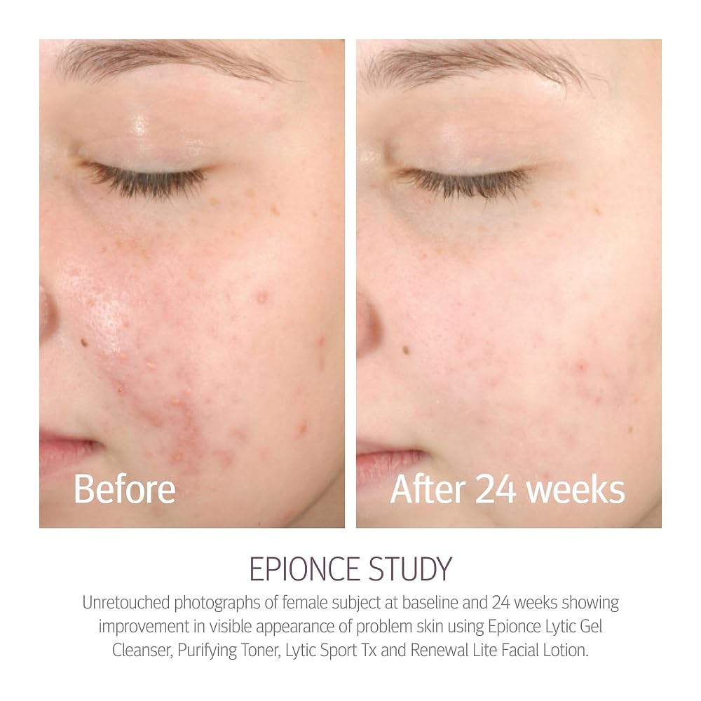 Epionce Renewal Lite label detail highlighting clean ingredients.