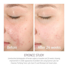 Epionce Renewal Lite label detail highlighting clean ingredients.