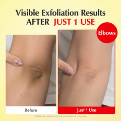 EQQUALBERRY Bromelain enzyme exfoliation image illustrating gentle texture refinement.
