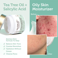 Era Organics crema arbol de te - textura suave que se absorbe rápido.