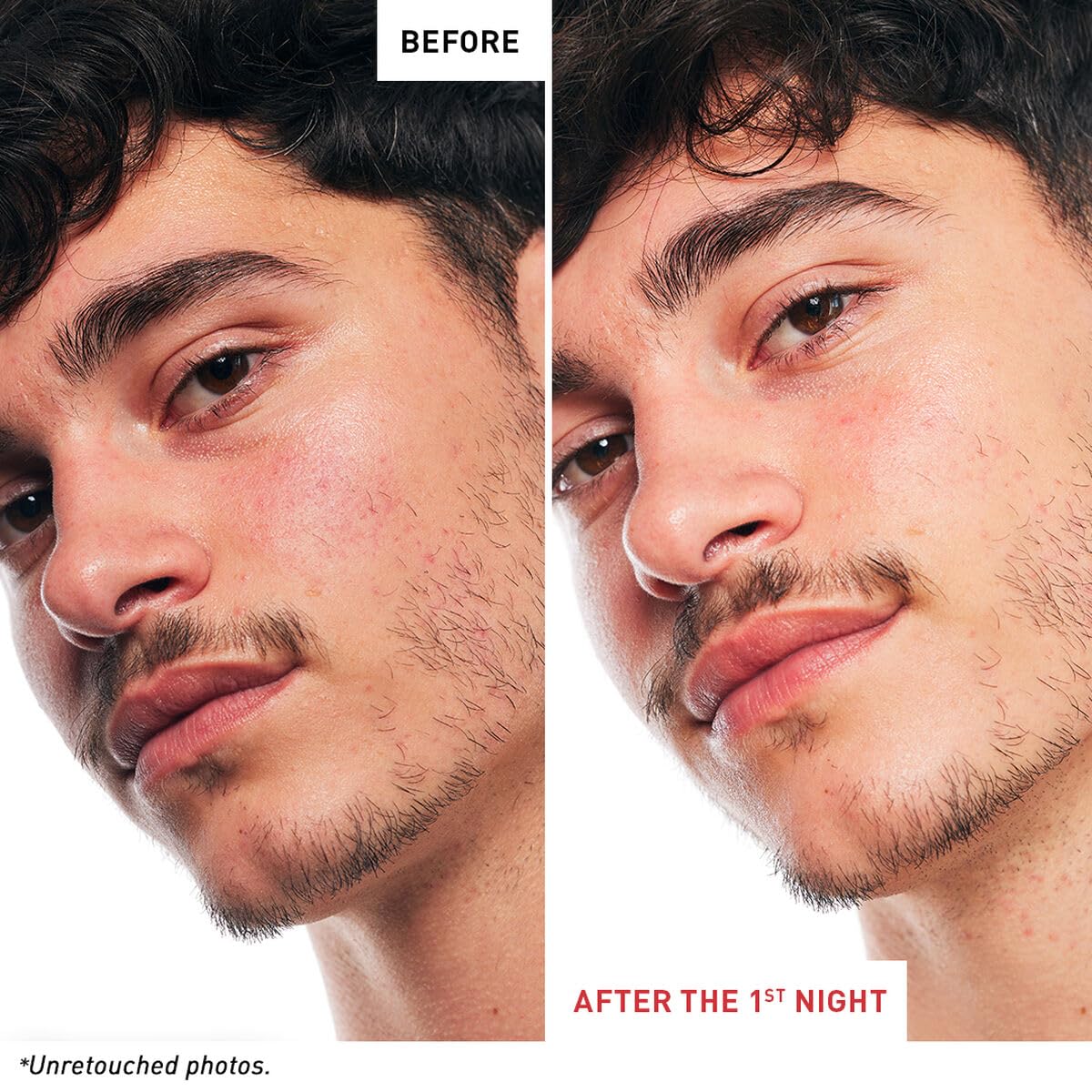 Erborian Skin Therapy: beneficios 7 en una sola fórmula para la piel.